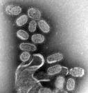 Photo Credit: Cynthia Goldsmith. Virus de la influenza Photo Credit: Cynthia Goldsmith. Virus de la influenza